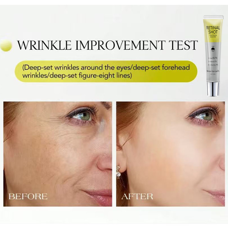 Retinal 0.1% Intensive Shot Pa - Retinol Anti Wrinkle Cream 评论和价格
